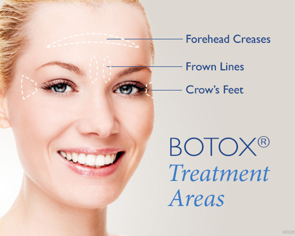 Botox trouble spots