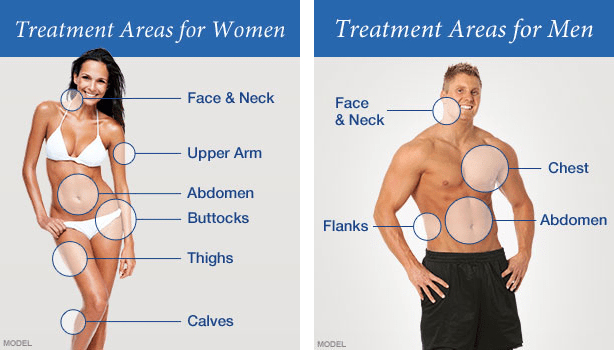liposuction treatment areas